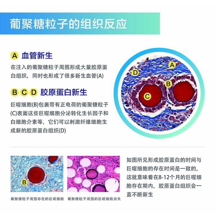 葡聚糖干细胞的成份 葡聚糖生物肋骨鼻的原理_ec5e255a.jpg